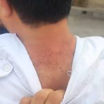 اورژانس
