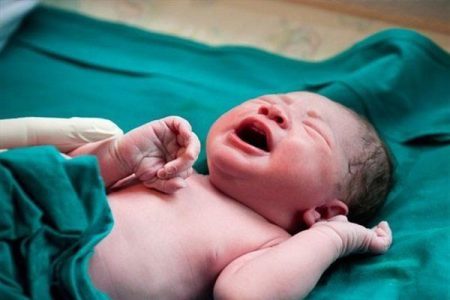 شیوع بیماری کم کاری تیروئید نوزادان در کشور